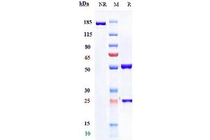 Anti- Human PD-1( Pembrolizumab) on SDS-PAGE under reducing (R) condition. (Recombinant PDCD1 (Pembrolizumab Biosimilar) 抗体)