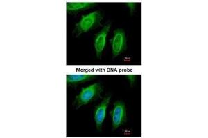 ICC/IF Image Immunofluorescence analysis of paraformaldehyde-fixed HeLa, using SH3GL1, antibody at 1:200 dilution. (SH3GL1 抗体  (Center))