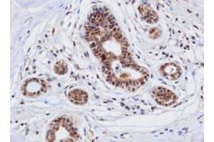 Immunohistochemistry (IHC) image for anti-Cathepsin D (CTSD) (AA 21-412) antibody (ABIN317502) (Cathepsin D 抗体  (AA 21-412))