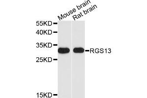 Western blot analysis of extracts of various cell lines, using RGS13 antibody. (RGS13 抗体)