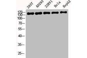 Western Blot analysis of 293T AD293 22RV1 HELA HepG2 cells using BAF170 Polyclonal Antibody (SMARCC2 抗体  (Internal Region))