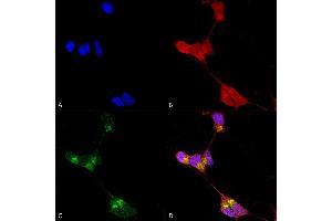Immunocytochemistry (ICC) image for anti-gamma-aminobutyric Acid (GABA) A Receptor, alpha 1 (GABRA1) (AA 15-34) antibody (Biotin) (ABIN2485004)