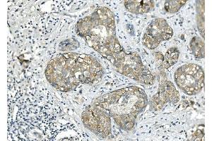IHC analysis of BubR1/BUB1B using anti-BubR1/BUB1B antibody (ABIN7600960). (BUB1B 抗体  (AA 26-448))