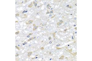 Immunohistochemistry of paraffin-embedded rat brain using RPLP1 antibody at dilution of 1:100 (x40 lens). (RPLP1 抗体)