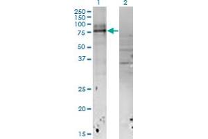 Western Blot analysis of IL18RAP expression in transfected 293T cell line by IL18RAP monoclonal antibody (M04), clone 4G4. (IL18RAP 抗体  (AA 20-129))