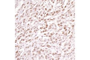Immunohistochemistry (IHC) image for anti-Damage Specific DNA Binding Protein 1 (DDB1) (C-Term) antibody (ABIN7454634) (DDB1 抗体  (C-Term))