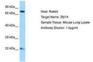 ZNF569 antibody  (C-Term)