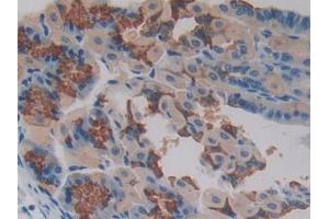 IHC-P analysis of Mouse Stomach Tissue, with DAB staining. (PAG1 抗体  (AA 160-390))