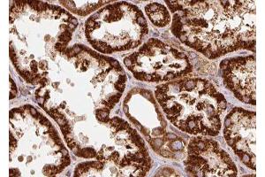 ABIN6277332 at 1/100 staining human kidney tissue sections by IHC-P. (TRAP1 抗体  (Internal Region))