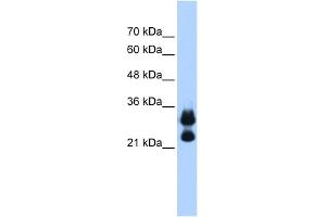 WB Suggested Anti-HIST1H1C Antibody Titration:  0. (HIST1H1C 抗体  (Middle Region))