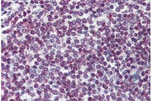 Human Spleen: Formalin-Fixed, Paraffin-Embedded (FFPE) (FOXO3 抗体  (AA 361-460))