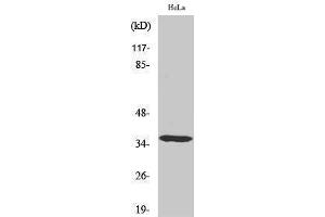 Western Blotting (WB) image for anti-Casein Kinase 1, alpha 1 (CSNK1A1) (Internal Region) antibody (ABIN3183657) (CSNK1A1 抗体  (Internal Region))
