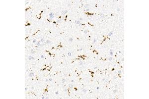 Immunohistochemistry of paraffin-embedded human brain using CD68 antibody (ABIN7266211) at dilution of 1:50 (40x lens). (CD68 抗体)