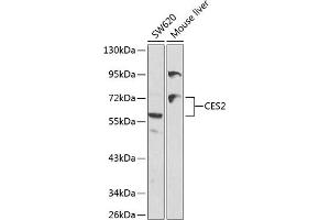 Western blot analysis of extracts of various cell lines, using CES2 antibody (ABIN3022047, ABIN3022048, ABIN3022049 and ABIN6218583) at 1:1000 dilution. (CES2 抗体  (AA 310-410))
