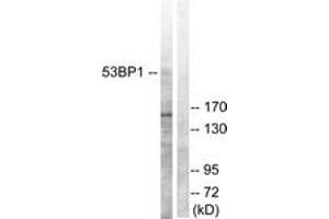 Western blot analysis of extracts from A549 cells, using 53BP1 (Ab-6) Antibody.