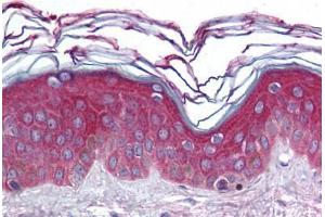 Human Skin (formalin-fixed, paraffin-embedded) stained with ARHGEF11 antibody ABIN296726 at 10 ug/ml followed by biotinylated goat anti-rabbit IgG secondary antibody ABIN481713, alkaline phosphatase-streptavidin and chromogen. (ARHGEF11 抗体  (AA 1-50))