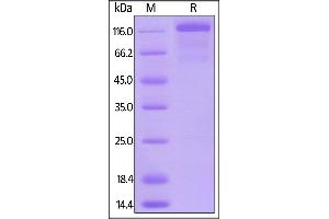 Mouse VEGF R3, Mouse IgG2a Fc Tag, low endotoxin on  under reducing (R) condition.