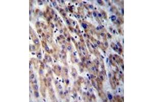 Formalin fixed and paraffin embedded human liver tissue stained with CPN1 Antibody (Center) followed by peroxidase conjugation of the secondary antibody and DAB staining. (CPN1 抗体  (Middle Region))