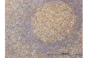 Immunoperoxidase of monoclonal antibody to SURB7 on formalin-fixed paraffin-embedded human tonsil. (MED21 抗体  (AA 1-144))