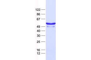 Western Blotting (WB) image for Zinc Finger Protein 200 (ZNF200) protein (His tag) (ABIN2735952)