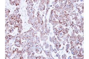 IHC-P Image Immunohistochemical analysis of paraffin-embedded OVCAR3 xenograft, using Ribosome binding protein 1, antibody at 1:500 dilution. (RRBP1 抗体  (C-Term))