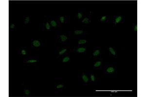 Immunofluorescence of monoclonal antibody to HMX2 on HeLa cell. (HMX2 抗体  (AA 125-224))