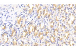 Immunohistochemistry (IHC) image for anti-Histidine-Rich Glycoprotein (HRG) (AA 106-302) antibody (ABIN7440872)