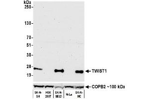 Western Blotting (WB) image for anti-Twist Homolog 1 (Drosophila) (TWIST1) (AA 1-50) antibody (ABIN7453340)