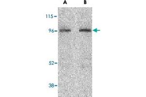 Western blot analysis of NOD2 in HeLa cell lysate with NOD2 polyclonal antibody  at (A) 2 and (B) 4 ug/mL . (NOD2 抗体  (C-Term))