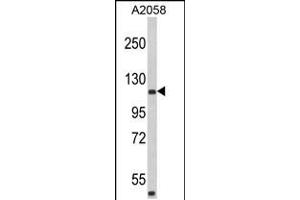 Western blot analysis of HMHA1 Antibody in A2058 cell line lysates (35ug/lane) (HMHA1 抗体  (AA 877-903))