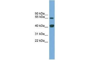WB Suggested Anti-Lmx1a Antibody Titration: 0.