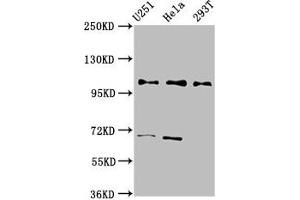Western Blot Positive WB detected in: U251 whole cell lysate, Hela whole cell lysate, 293T whole cell lysate All lanes: PRPF40A antibody at 2. (PRPF4 抗体  (AA 120-266))