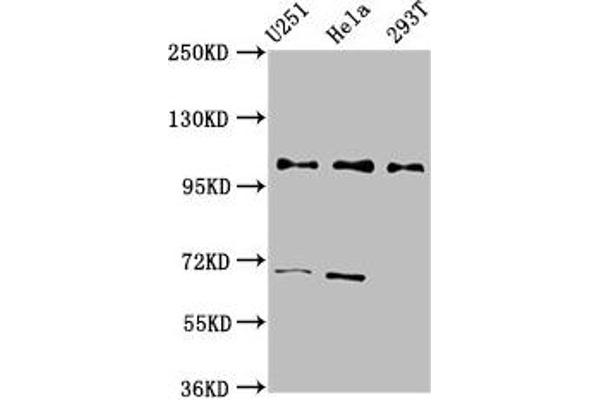 PRPF4 Antikörper  (AA 120-266)