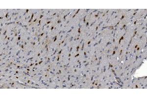 IHC analysis of Alpha B Crystallin/CRYAB using anti-Alpha B Crystallin/CRYAB antibody (ABIN7601209).