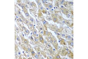 Immunohistochemistry of paraffin-embedded human liver using SGSH antibody at dilution of 1:100 (40x lens). (SGSH 抗体)