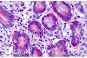 Human Small Intestine: Formalin-Fixed, Paraffin-Embedded (FFPE) (ST14 抗体  (AA 10-59))