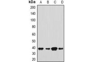 Western blot analysis of SH3GL2 expression in Hela (A), HepG2 (B), mouse brain (C), mouse testis (D) whole cell lysates. (SH3G2 抗体)