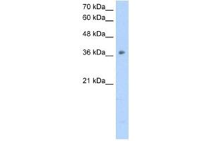 OTC antibody used at 2. (OTC 抗体  (N-Term))