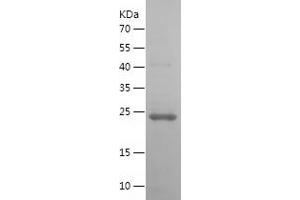 Oncostatin M (OSM) (AA 26-221) protein (His tag)