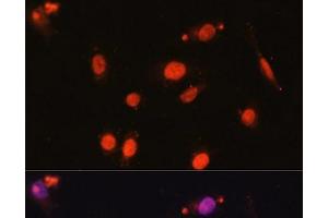 Immunofluorescence analysis of U2OS cells using DDX17 Polyclonal Antibody at dilution of 1:100. (DDX17 抗体)