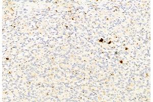 ABIN6264908 and ABIN6277802 at 1/100 staining Rat stomach tissue by IHC-P. (S100A9 抗体  (C-Term))