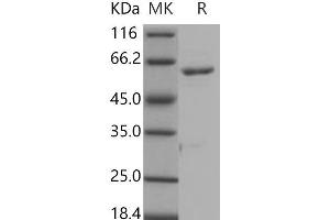 Western Blotting (WB) image for Receptor Tyrosine Kinase-Like Orphan Receptor 1 (ROR1) (AA 453-783) (Active) protein (GST tag,His tag) (ABIN7317047) (ROR1 Protein (AA 453-783) (GST tag,His tag))