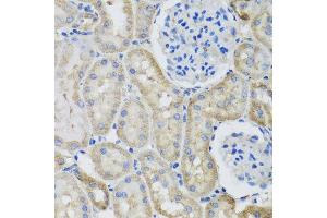 Immunohistochemistry of paraffin-embedded rat kidney using GFER antibody at dilution of 1:100 (x40 lens). (GFER 抗体)