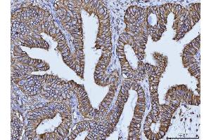 IHC analysis of CD147/Emmprin using anti-CD147/Emmprin antibody (ABIN7599997). (CD147 抗体  (AA 138-323))