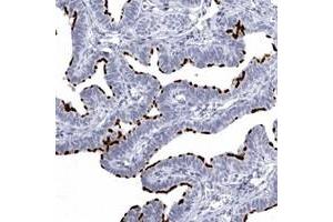 Immunohistochemical staining of human fallopian tube with C1orf114 polyclonal antibody  shows strong membranous positivity in glandular cells.