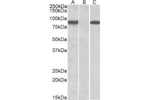 HEK293 lysate (10ug protein in RIPA buffer) overexpressing Human STAT4 (RC206892) with C-terminal MYC tag probed with ABIN571128 (1ug/ml) in Lane A and probed with anti-MYC Tag (1/1000) in lane C.