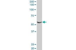 FLI1 monoclonal antibody (M03), clone 2A2. (FLI1 抗体  (AA 1-452))