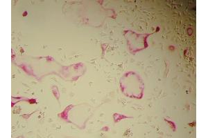 Immunohistochemistry (IHC) image for Osteoclast (Rat) Culture Kit (ABIN956046) (Osteoclast (大鼠) Culture Kit)