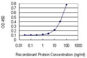 Detection limit for recombinant GST tagged FBXL19 is 3 ng/ml as a capture antibody. (FBXL19 抗体  (AA 365-472))