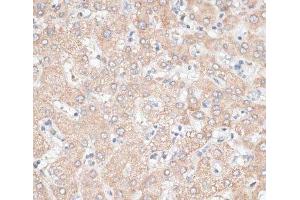 Immunohistochemistry (Paraffin-embedded Sections) (IHC (p)) image for anti-Glypican 3 (GPC3) antibody (ABIN7008556)